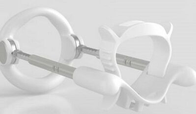extension to increase the member